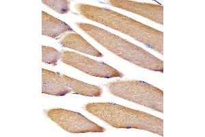 Immunohistochemistry (Paraffin-embedded Sections) (IHC (p)) image for anti-Vinculin (VCL) (AA 903-937) antibody (ABIN6242694)