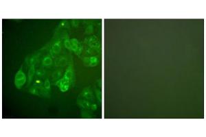 Immunofluorescence analysis of A549 cells, using Connexin 43 antibody.