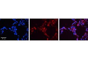 SFTPB antibody - middle region          Formalin Fixed Paraffin Embedded Tissue:  Human Lung Tissue    Observed Staining:  Cytoplasm and membrane of pneumocytes   Primary Antibody Concentration:  1:600    Secondary Antibody:  Donkey anti-Rabbit-Cy3    Secondary Antibody Concentration:  1:200    Magnification:  20X    Exposure Time:  0. (SFTPB antibody  (Middle Region))