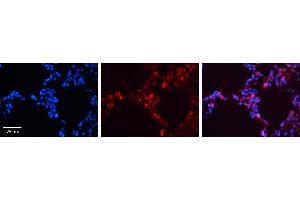 SFTPB antibody - middle region          Formalin Fixed Paraffin Embedded Tissue:  Human Lung Tissue    Observed Staining:  Cytoplasm and membrane of pneumocytes   Primary Antibody Concentration:  1:600    Secondary Antibody:  Donkey anti-Rabbit-Cy3    Secondary Antibody Concentration:  1:200    Magnification:  20X    Exposure Time:  0.