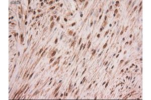 Image no. 2 for anti-Myc Proto-Oncogene protein (MYC) antibody (ABIN1497012) (c-MYC antibody)