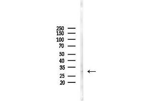 Western blot analysis of lysates from Mouse liver, using HOX Antibody at 1/1000 dilution.