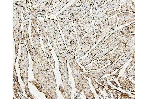 IHC analysis of ALDOA using anti-ALDOA antibody (ABIN7601907). (ALDOA antibody  (AA 50-364))