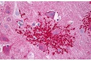 Anti-CXCR4 antibody IHC staining of human brain, astrocytes microglia. (CXCR4 antibody  (AA 300-349))