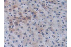 IHC-P analysis of Human Liver Tissue, with DAB staining. (BIRC2 antibody  (AA 344-593))