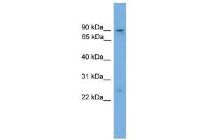 WB Suggested Anti-Zfy1 Antibody Titration: 0. (ZFY1 antibody  (Middle Region))