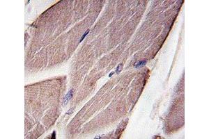 IHC analysis of FFPE human skeletal muscle tissue stained with PDK4 (PDK4 antibody  (AA 250-277))