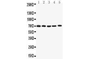 Western Blotting (WB) image for anti-Potassium Voltage-Gated Channel, Shaker-Related Subfamily, Member 4 (KCNA4) (AA 329-344), (Middle Region) antibody (ABIN3042541) (Kv1.4 antibody  (Middle Region))