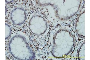 Immunoperoxidase of monoclonal antibody to GTF3C2 on formalin-fixed paraffin-embedded human colon tissue. (GTF3C2 antibody  (AA 1-911))