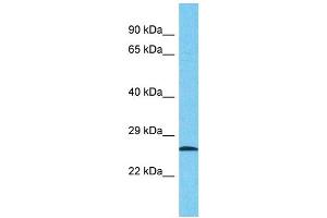 Western Blotting (WB) image for anti-Nuclear Pore Complex Interacting Protein Family, Member B7 (NPIPB7) (Middle Region) antibody (ABIN2791704) (NPIPL1 antibody  (Middle Region))