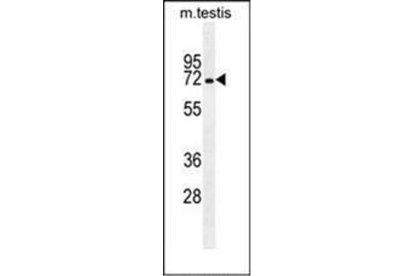 MBTD1 antibody  (C-Term)