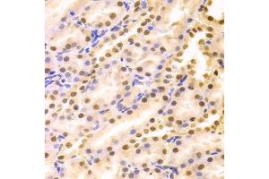 Immunohistochemistry of paraffin-embedded rat kidney using HDGF Antibody. (HDGF antibody  (AA 1-240))