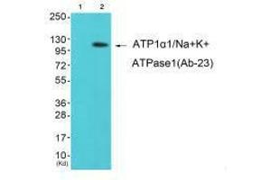 Western blot analysis of extracts from K562 cells (Lane 2), using ATP1α1/Na+K+ ATPase1 (Ab-23) antiobdy. (ATP1A1 antibody  (Ser23))