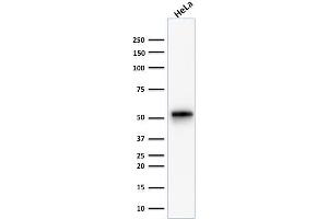 Western Blot Analysis of human HeLa cell lysate using Cytokeratin 7 Rabbit Monoclonal Antibody (KRT7/1499R). (Cytokeratin 7 antibody)