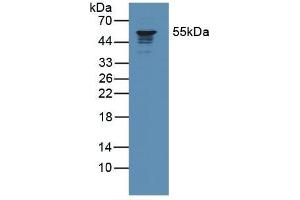 Western blot analysis of Human Jurkat Cells. (Coronin 1a antibody  (AA 7-204))