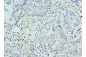 Immunohistochemistry (IHC) image for anti-Arginase, Type II (ARG2) (AA 1-354) antibody (ABIN6098038) (ARG2 antibody  (AA 1-354))