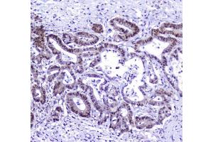 IHC analysis of AHR using anti-AHR antibody (ABIN6719265). (Aryl Hydrocarbon Receptor antibody)