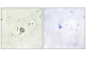 Immunohistochemistry analysis of paraffin-embedded human brain tissue using CELSR3 antibody. (CELSR3 antibody)
