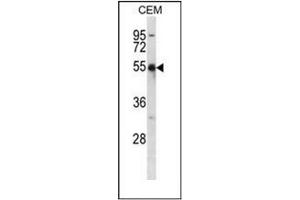 Western blot analysis of KCNA2 Antibody (C-term) in CEM cell line lysates (35ug/lane). (KCNA2 antibody  (C-Term))