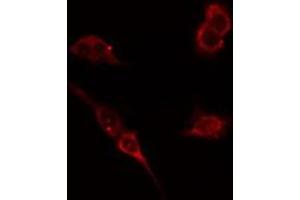ABIN6276430 staining HepG2 cells by IF/ICC. (WASP antibody  (Internal Region))