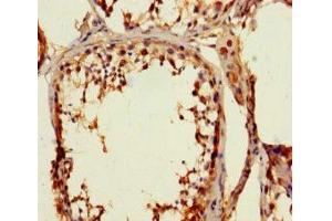 Immunohistochemistry of paraffin-embedded human testis tissue using ABIN7176521 at dilution of 1:100 (ZNF77 antibody  (AA 1-300))
