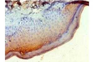 Immunohistochemistry of paraffin-embedded human skin tissue using ABIN7145570 at dilution of 1:100 (NDST1 antibody  (AA 40-556))