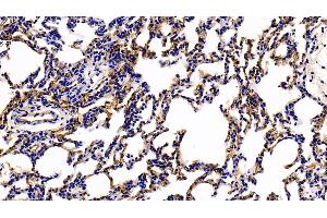 Detection of TM in Rat Lung Tissue using Polyclonal Antibody to Thrombomodulin (TM) (Thrombomodulin antibody  (AA 31-167))
