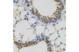 Immunohistochemistry of paraffin-embedded mouse lung using CD59 antibody (ABIN3212238) (40x lens). (CD59 antibody)