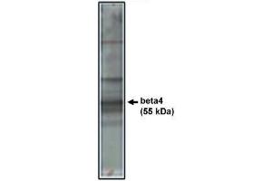 Image no. 1 for anti-Calcium Channel, Voltage-Dependent, beta 4 Subunit (CACNB4) antibody (ABIN265039) (CACNB4 antibody)