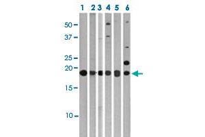 Western blot analysis of Lane 1: 293 cell lysates, Lane 2: Ramos cell lysates, Lane 3: HeLa cell lysates, Lane 4: HepG2 cell lysates, Lane 5: T47D cell lysates, Lane 6: Jurkat cell lysates with MAP1LC3C polyclonal antibody  at 1:1000 dilution. (LC3C antibody  (AA 1-30))
