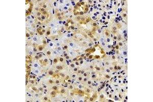 Immunohistochemical analysis of HIWI2 staining in rat kidney formalin fixed paraffin embedded tissue section. (PIWIL4 antibody)