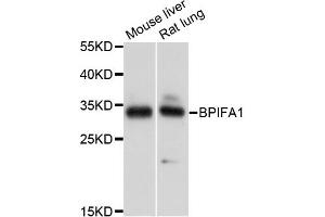 Western blot analysis of extracts of various cell lines, using BPIFA1 antibody.