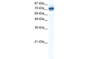 Western Blotting (WB) image for anti-Zinc Finger and SCAN Domain Containing 29 (ZSCAN29) antibody (ABIN2461307) (ZSCAN29 antibody)