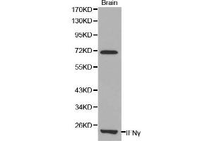 Western blot analysis of mouse brain cell lysate using IFNG antibody. (Interferon gamma antibody)