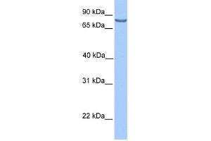 WB Suggested Anti-LCA5 Antibody Titration: 0. (LCA5 antibody  (N-Term))