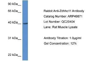 Western Blotting (WB) image for anti-Zinc Finger, DHHC-Type Containing 11 (ZDHHC11) (Middle Region) antibody (ABIN2783945) (ZDHHC11 antibody  (Middle Region))