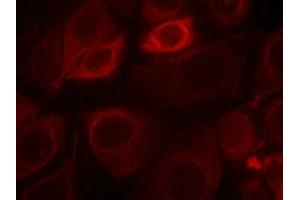 Immunofluorescence staining of methanol-fixed MCF7 cells using Her3/ErbB3(phospho-Tyr1328) Antibody. (ERBB3 antibody  (pTyr1328))