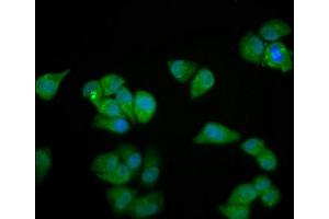 Immunofluorescence staining of Hela cells with ABIN7160664 at 1:100, counter-stained with DAPI. (MYOZ2 antibody  (AA 90-180))