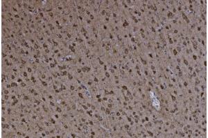 IHC analysis of FABP-1/GOT2 using anti-FABP-1/GOT2 antibody (ABIN7601426). (GOT2 antibody  (AA 35-430))