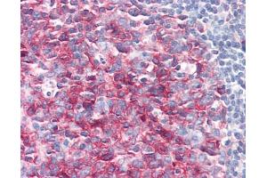 Tonsil: Formalin-Fixed, Paraffin-Embedded (FFPE) (PAG1 antibody  (AA 97-432))