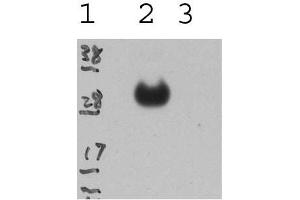 Lane 1 - Marker; Lane - GP fusion protein; Lane 3 - Control (GFP antibody)