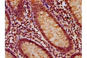 IHC image of ABIN7158363 diluted at 1:200 and staining in paraffin-embedded human appendix tissue performed on a Leica BondTM system. (LMO7 antibody  (AA 1301-1465))