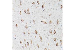 Immunohistochemistry (IHC) image for anti-ATG16 Autophagy Related 16-Like 1 (ATG16L1) (AA 200-300) antibody (ABIN6137248)