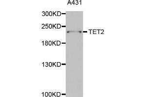 Western blot analysis of extracts of A-431 cells, using TET2 antibody. (TET2 antibody)