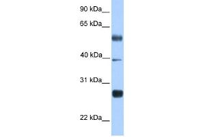 WB Suggested Anti-MXD3 Antibody Titration:  0. (MXD3 antibody  (N-Term))