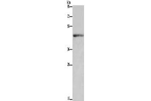 Western Blotting (WB) image for anti-Interleukin 5 Receptor, alpha (IL5RA) antibody (ABIN5549967) (IL5RA antibody)