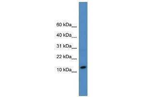 Western Blot showing SLPI antibody used at a concentration of 1-2 ug/ml to detect its target protein.