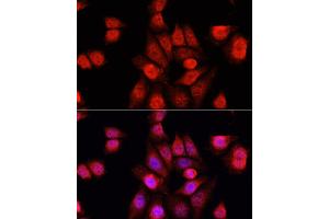 Immunofluorescence analysis of HeLa cells using RBFOX3 antibody (ABIN1874561) at dilution of 1:100. (NeuN antibody)