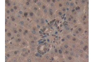 Immunohistochemistry (IHC) image for anti-CD2-Associated Protein (Cd2ap) (AA 368-623) antibody (ABIN7439519)