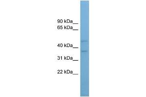WB Suggested Anti-AADACL4 Antibody Titration: 0. (AADACL4 antibody  (Middle Region))